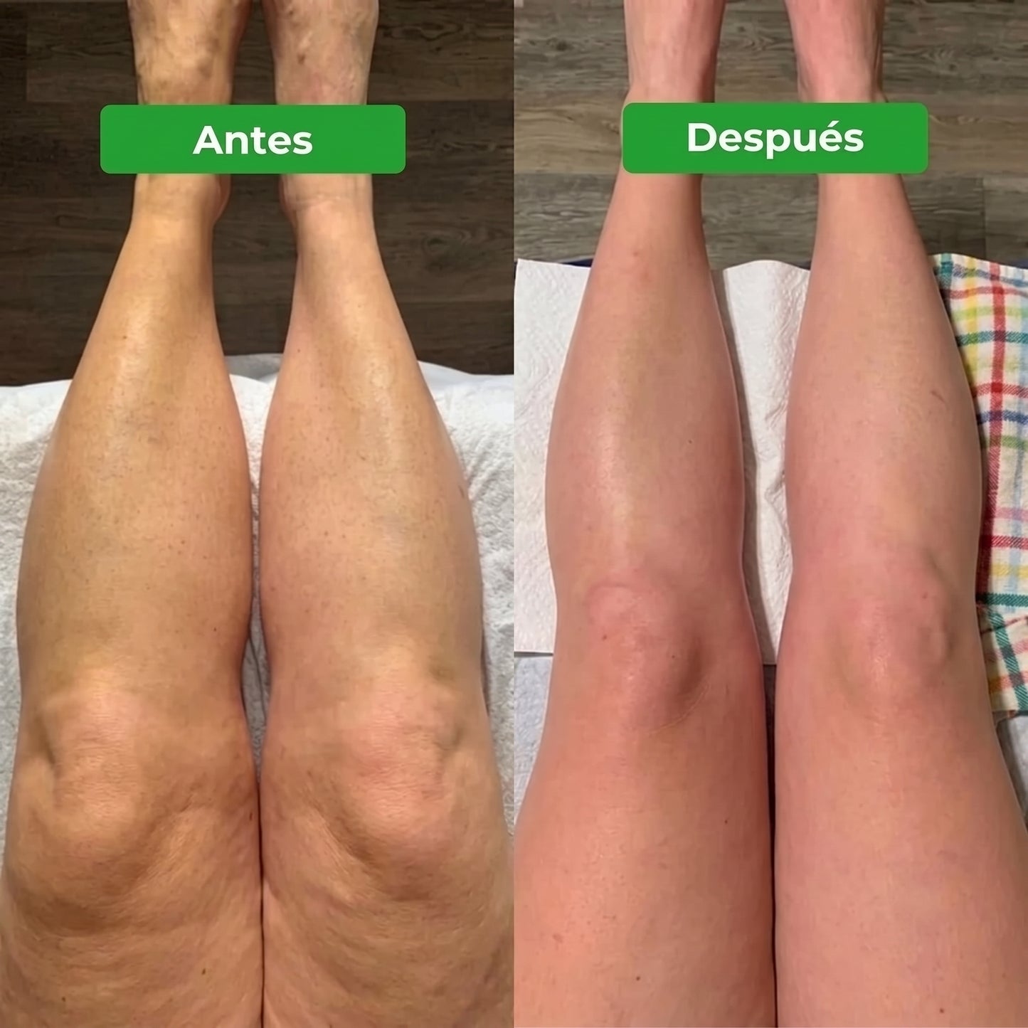 Drenaje Linfático Para Un Cuerpo Más Ligero