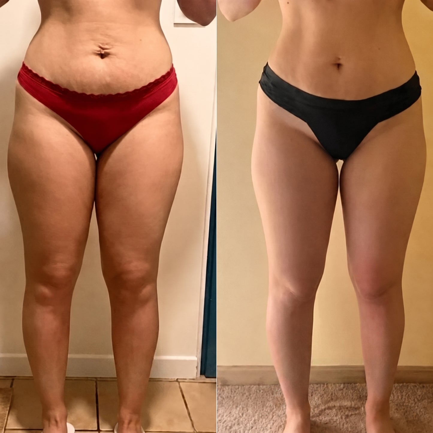 Drenaje Linfático Para Un Cuerpo Más Ligero