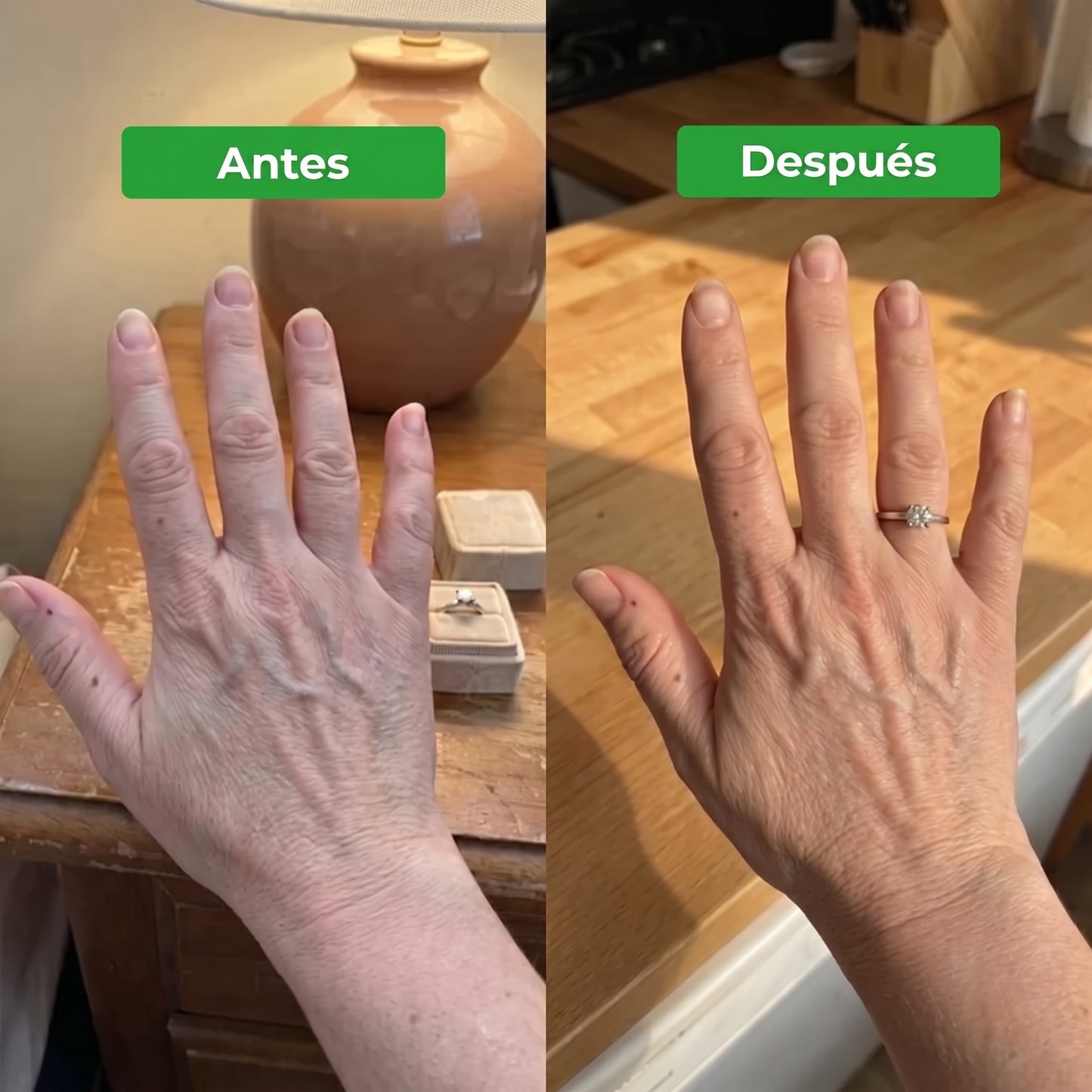 Drenaje Linfático Para Un Cuerpo Más Ligero